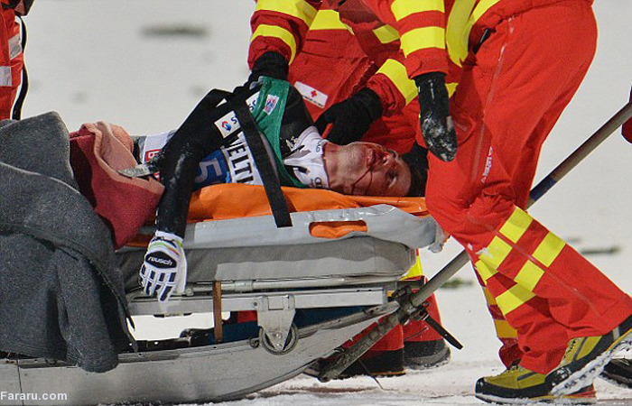 حادثه تلخ برای قهرمان اسکی جهان 1