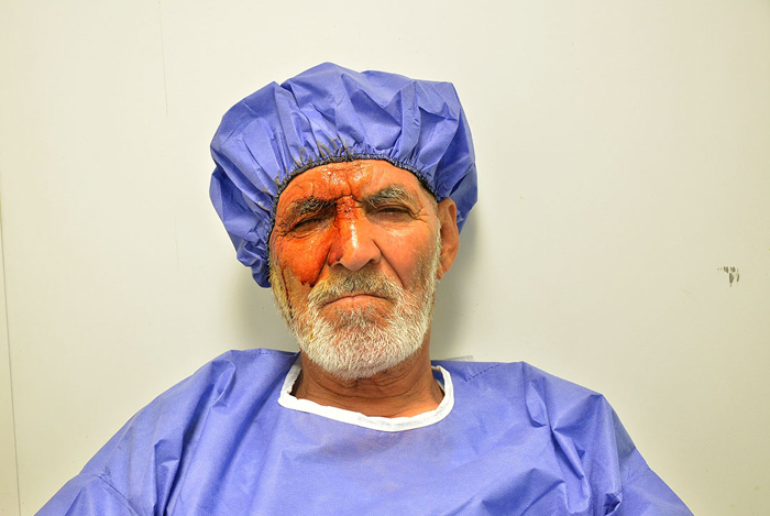 (تصاویر) جراحی‌خیریه وزیربهداشت در سیستان