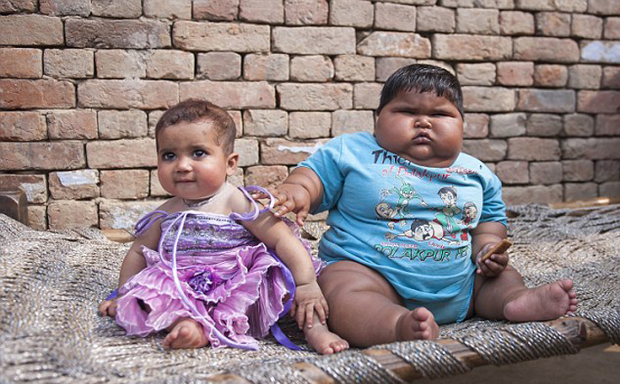 (تصاویر) چاقی کم سابقه نوزاد هندی