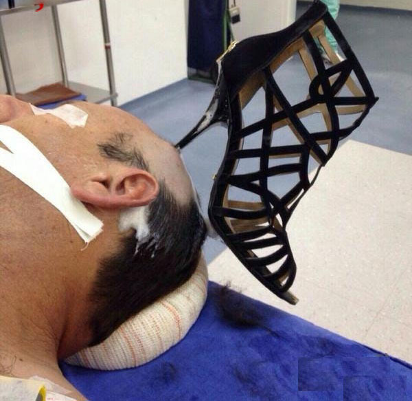 (تصویر) پاشنه کفش زن در سر شوهر جا ماند!