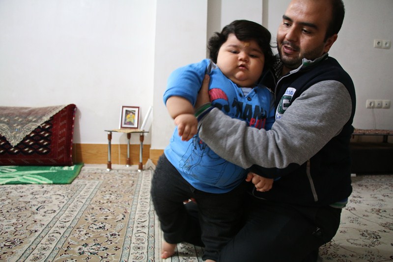 (تصاویر) کودک یک ساله بجنوردی با ۴۲ کیلو وزن