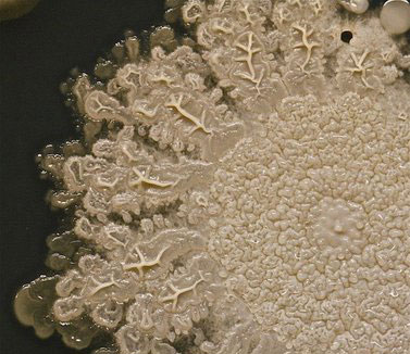 تصاویری جالب از میکروب‌های کف دست