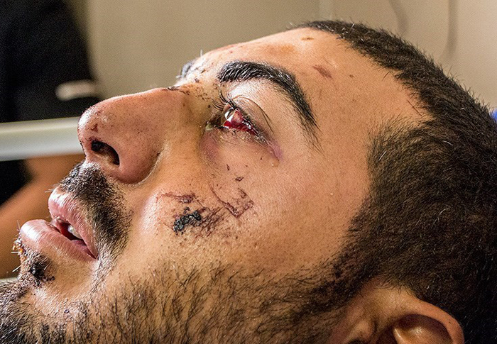 (تصاویر) عیادت امیرپوردستان از سربازان مجروح