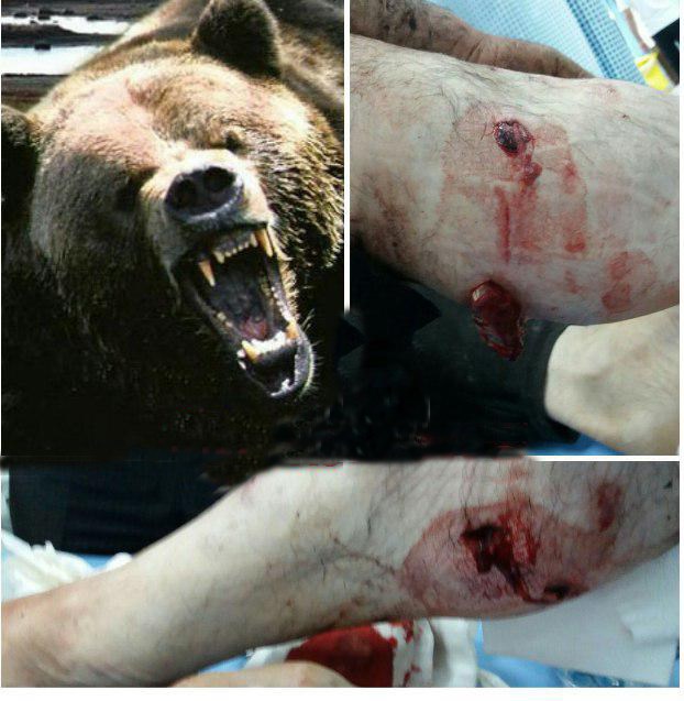 (عکس) حمله خرس به پیرمرد قزوینی