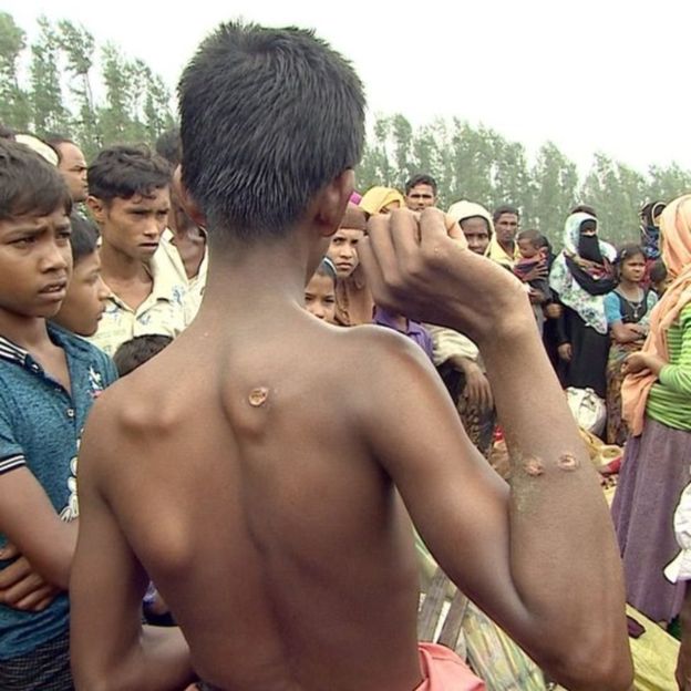 روایت‌های تکان‌دهنده از مسلمانان میانمار