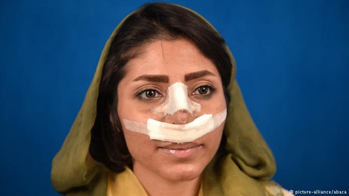 (تصاویر) گزارش خبرگزاری آلمانی از جراحی بینی در ایران