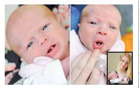 (تصویر) نوزادی که با یک دندان متولد شد!