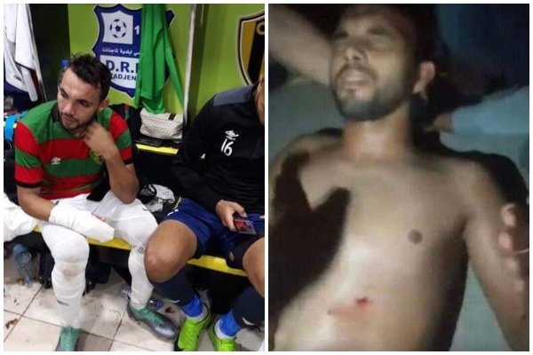 (تصویر) اتفاقی عجیب در لیگ فوتبال الجزایر