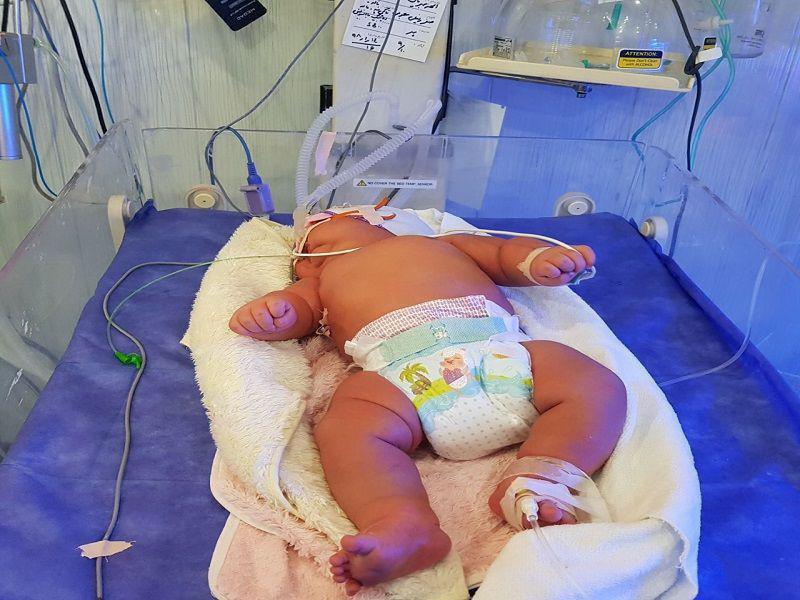 سنگین وزن ترین نوزاد ایران در یزد متولد شد