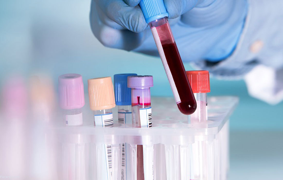 تفسیر نتایج آزمایش خون و آزمایش ادرار