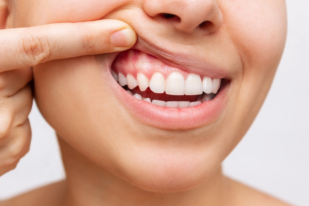 توصیه‌های بهداشتی برای مراقبت از دندان‌ها