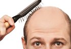 واقعیت‌هایی در مورد ریزش مو: ۸ باور اشتباه که باید فراموش کنید
