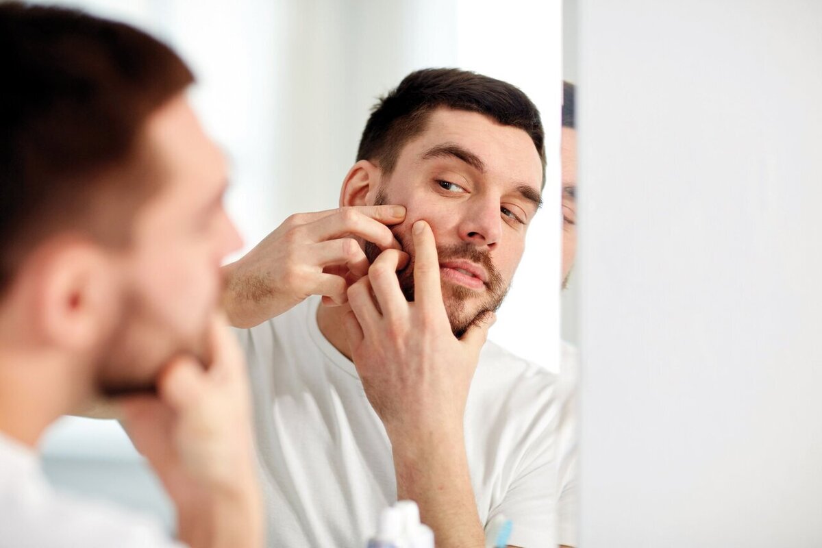 10 راهکار مؤثر برای از بین بردن جوش‌های صورت
