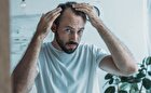چرا زندگی مدرن باعث ریزش مو‌های مردان می‌شود و چگونه از آن جلوگیری کنیم؟