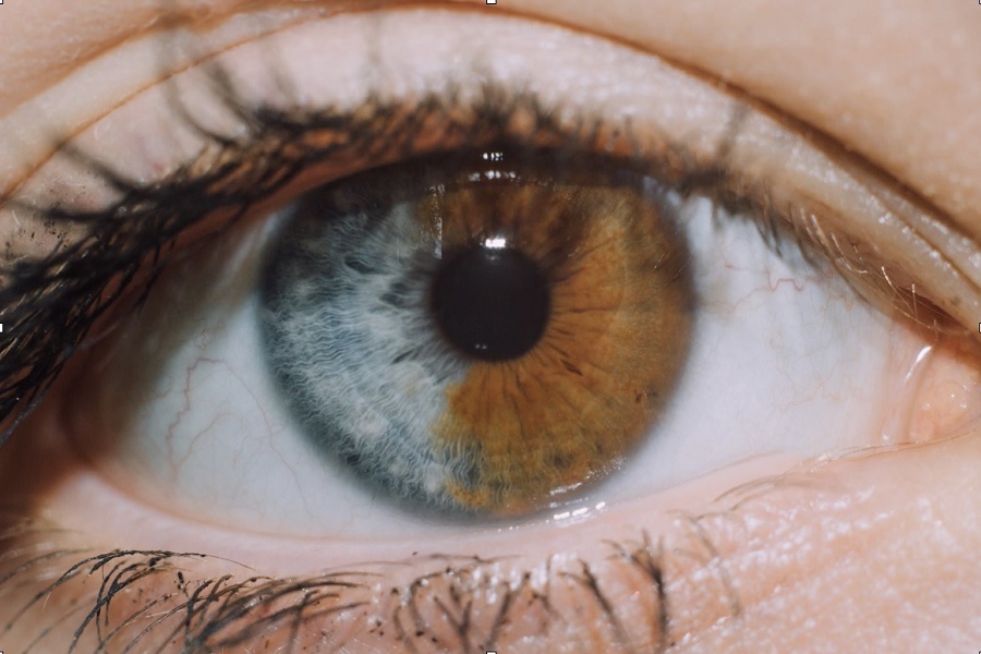 کمیاب‌ترین «رنگ چشم» جهان چه رنگی است؟