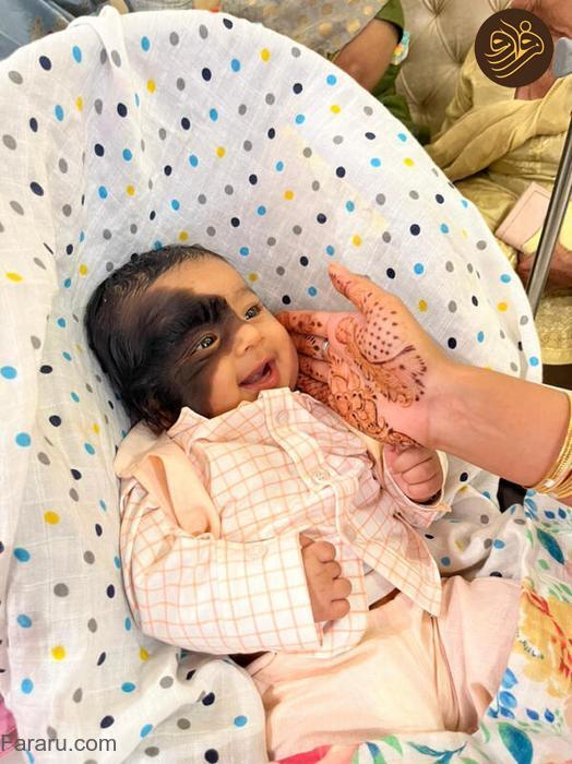 عکس هایی از تولد یک نوزاد با شمایلی باورنکردنی 