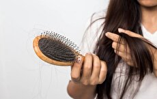ریزش چند تار مو در روز طبیعی است؟ | 1000tar.ir