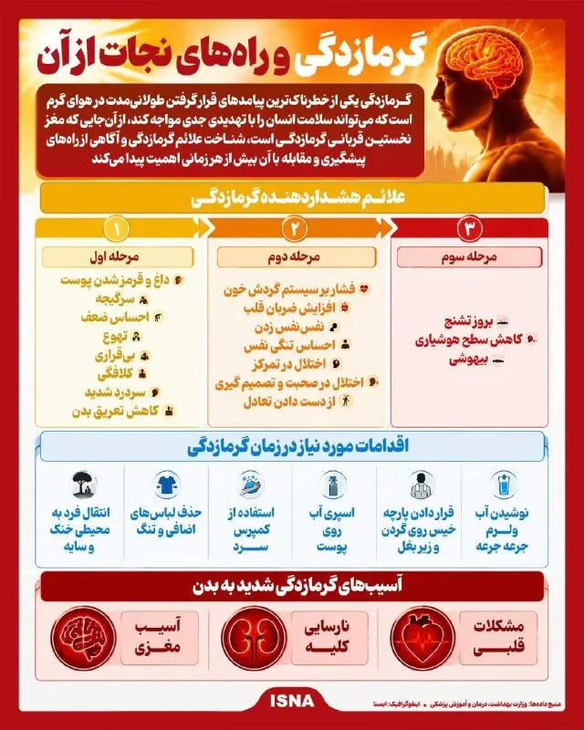 گرمازدگی