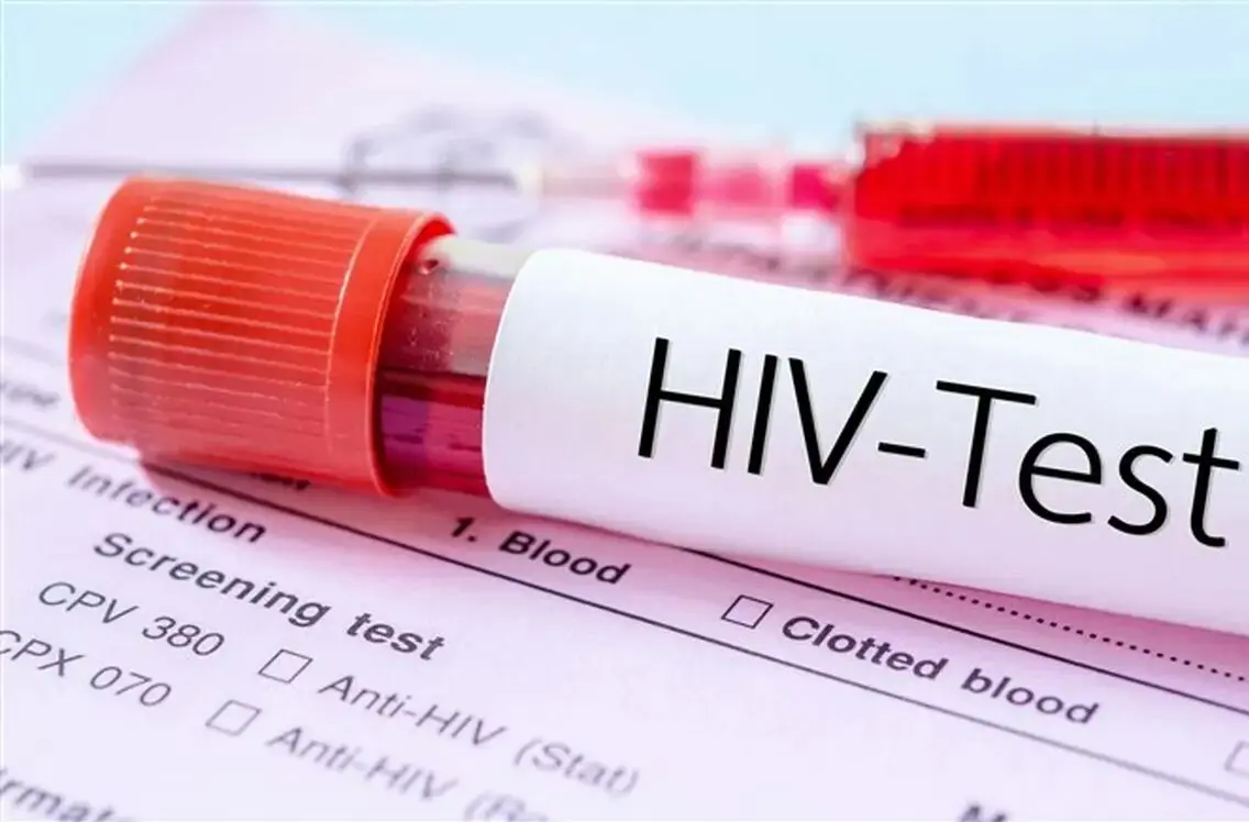 آمار هولناک ابتلا به ویروس HIV در کشور