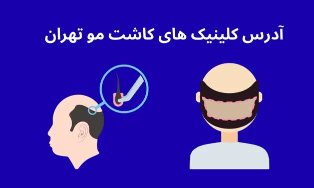 آدرس کلینیک های کاشت مو در تهران [ 10 مرکز فوق تخصصی ] 