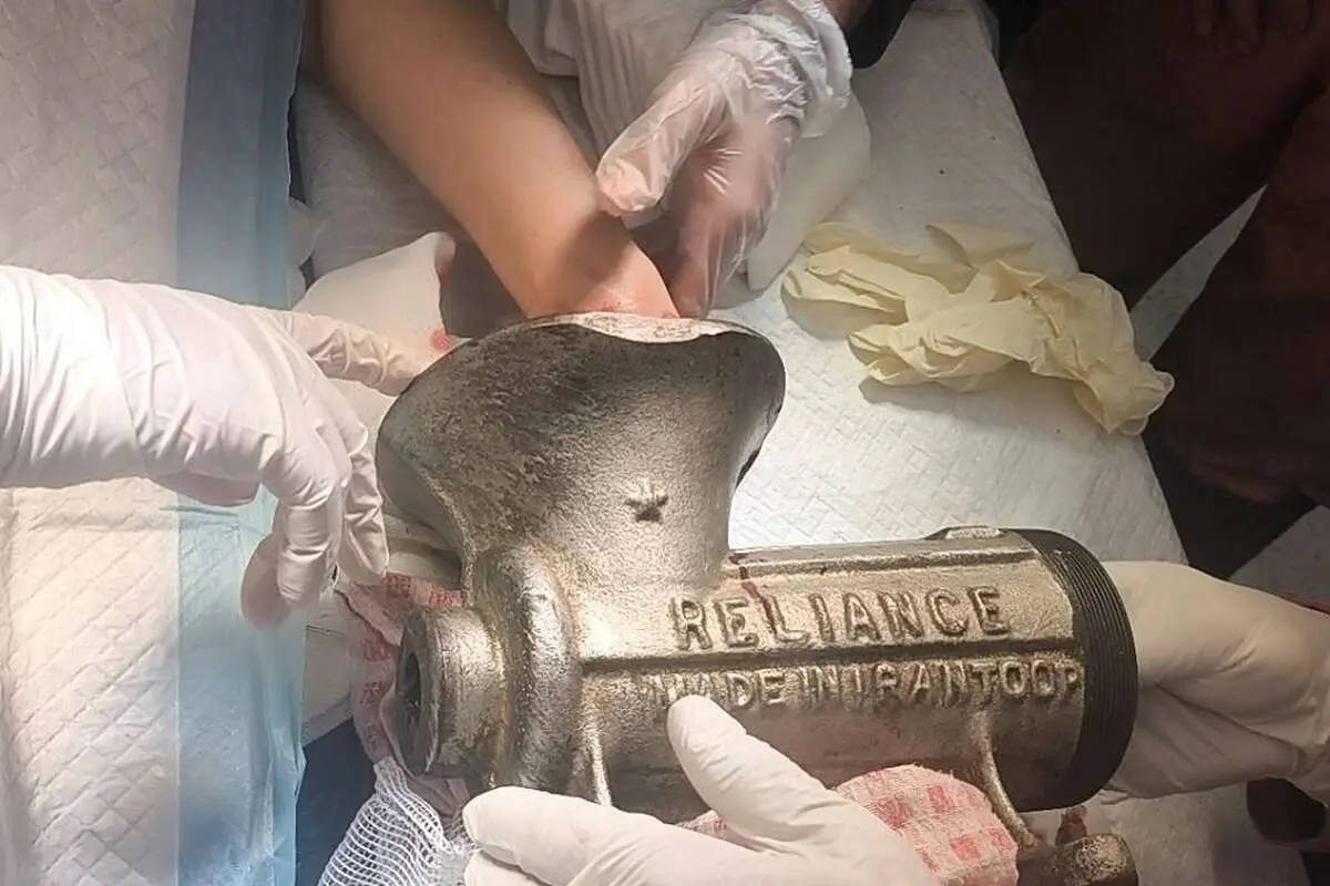 جراحت شدید دست زن کارگر در چرخ‌گوشت در مرکز تهران