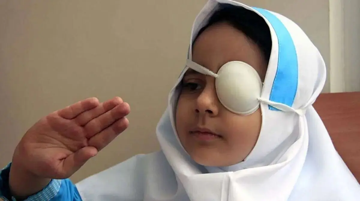 دلایل مهم تنبلی چشم در کودکان
