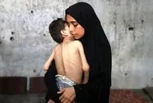 تصاویر؛ سایه قحطی مرگبار بر غزه