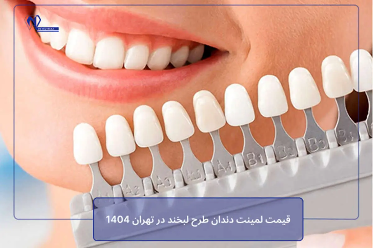 قیمت لمینت دندان طرح لبخند