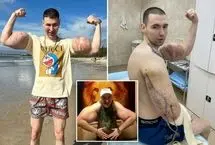 ملوان زبل روسی در آستانه قطع هر دو دست