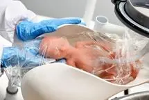 اختراع رحم مصنوعی برای نجات نوزادان زودرس از مرگ