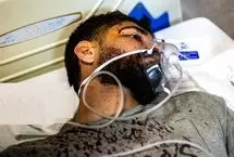 تصاویر؛ مجروحان حملات هوایی امروز به تهران
