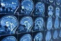 عکس واقعی و عجیب از یک بیگانه هنگام سی تی اسکن بیمار