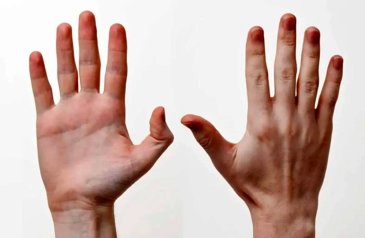 چرا انگشتان دست انسان این‌گونه شکل گرفته‌اند؟ 