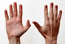 چرا انگشتان دست انسان این‌گونه شکل گرفته‌اند؟ 