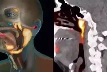 کشف عضوی جدید در بدن پس از 300 سال!