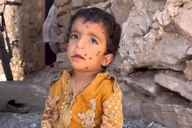 ببینید؛ وقتی سهم کودک از زندگی، هجوم مگس‌هاست