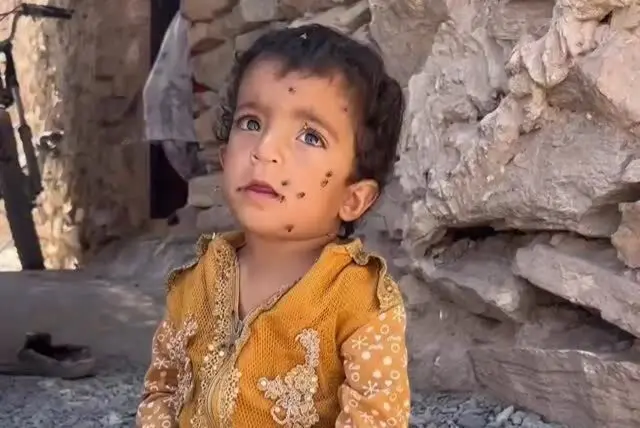 ببینید؛ وقتی سهم کودک از زندگی، هجوم مگس‌هاست