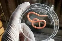 این ۱۲ علامت یعنی انگل‌ها در بدن‌تان جا خوش کرده‌اند!