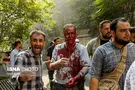 تصاویر دلخراش از تجاوز رژیم صهیونیستی به منطقه مسکونی غیرنظامی تهران