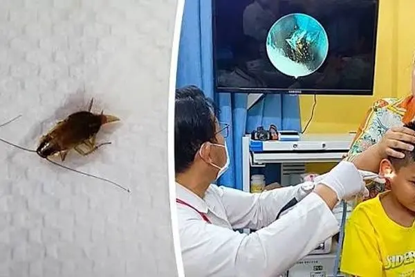 ببینید؛ خارج کردن سوسک زنده از گوش یک کودک