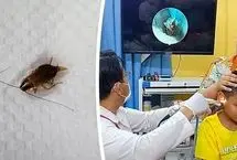 ببینید؛ خارج کردن سوسک زنده از گوش یک کودک