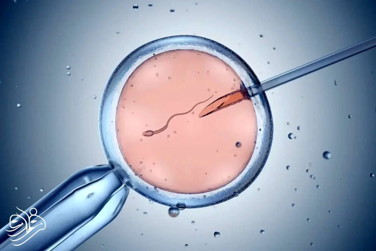 آیا در IVF شانس تولد پسر و دختر برابر است؟