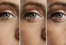 کشف راهکاری نوین برای درمان پیرچشمی