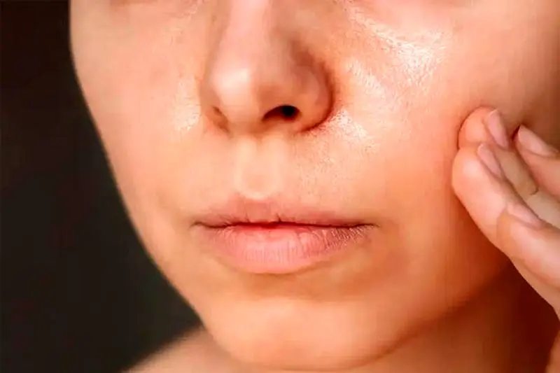 C:\Users\s\Desktop\Causes-of-oily-forehead-and-nose-3.jpg