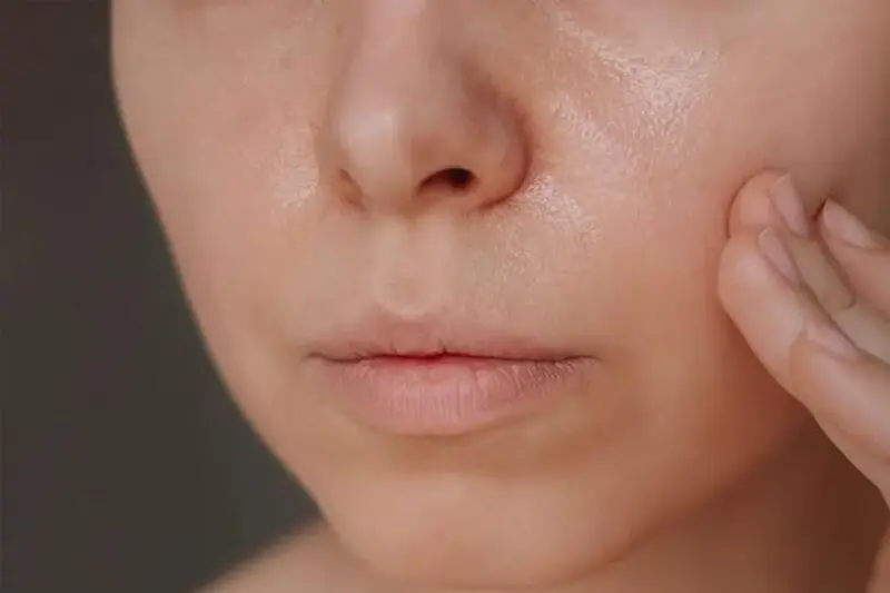 C:\Users\s\Desktop\Causes-of-oily-forehead-and-nose-3.jpg