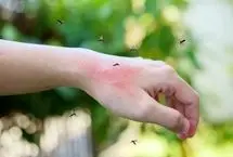 هر پشه‌ آدم مورد علاقه خودش را دارد!
