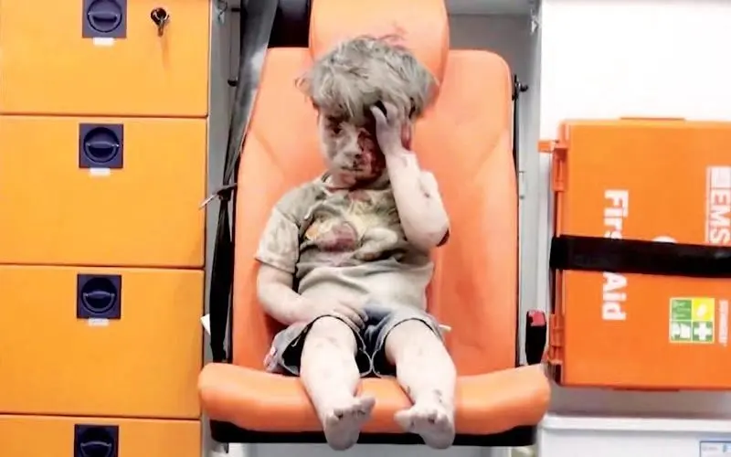 کودک سوری نجات‌یافته از زیر آوار 9 سال بعد