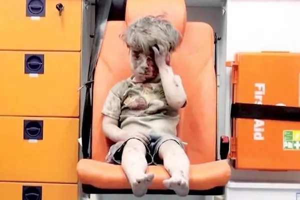 کودک سوری نجات‌یافته از زیر آوار 9 سال بعد