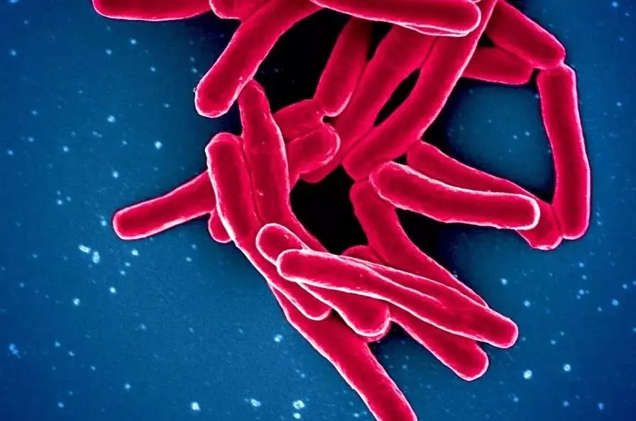 ۱.۲۳ میلیون نفر قربانی کشنده‌ترین بیماری عفونی جهان در سال ۲۰۲۴