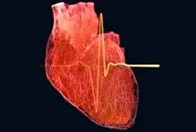 خطر بیماری قلبی در مردان از ۳۵ سالگی آغاز می‌شود